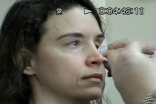 New Video: New Prosthetic Eye